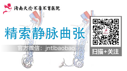 北京二代试管婴儿机构-健康-精索静脉曲张降低精子质量